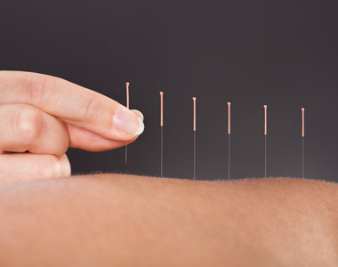 acupuncture-treatments-tcm-acupuncture-miami-benefits-results-body-lose weight
