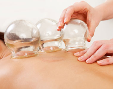 acupuncture-treatments-tcm-acupuncture-miami-benefits-results-body-lose weight-Cupping