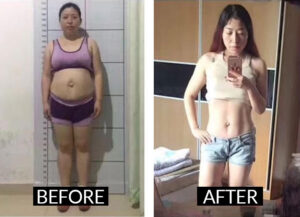 acupuncture-treatments-tcm-acupuncture-miami-benefits-results-body-lose weight