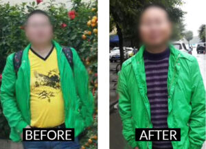 acupuncture-treatments-tcm-acupuncture-miami-benefits-results-body-lose weight