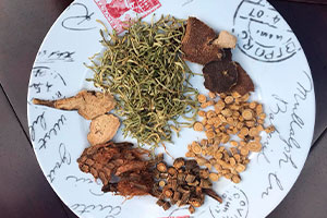 Tcm-acupuncture-Miami-body-mind-spirit-Treatment-Cupping treatment-Infertility treatment- Gua Sha treatment-Tui Na treatment-Herbal Medicine-Moxa Treatment- Skin Disease Treatment- Meditation & more- Tai JI/ Tai Chi